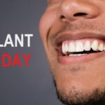 Je zubný implantát možný za jeden deň? Okamžitý zubný implantát v ten istý deň. Kto je vhodný, čo je potrebné, bolí to, aké sú riziká, cena a náklady?