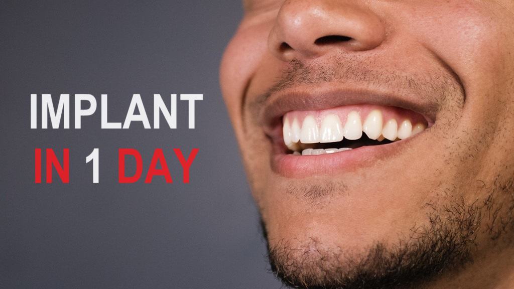 Is A Same Day Dental Implant Possible? Is it possible to get a dental implant in 1 day? Who is suitable, what is needed, does it hurt, what are the risks, price and cost?