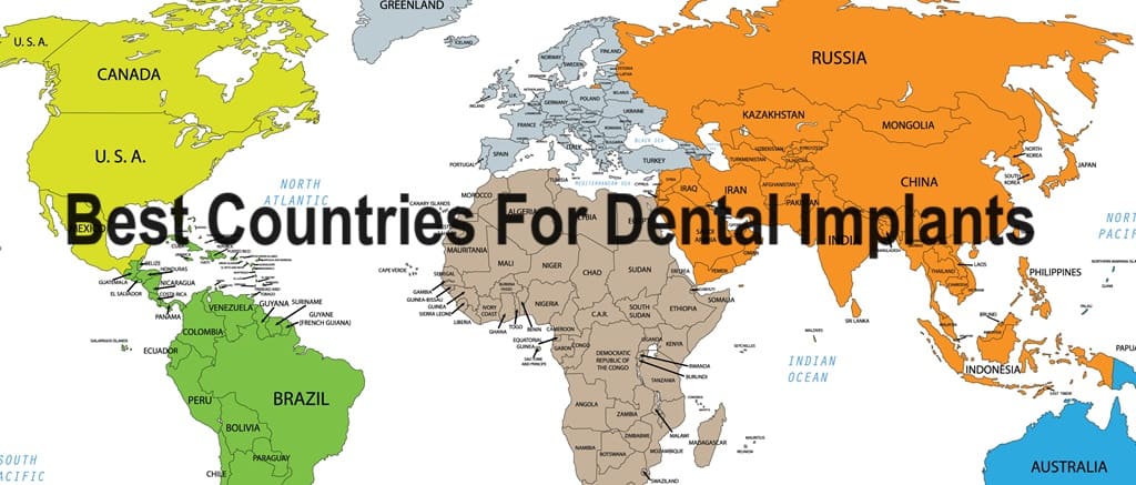 Která země je nejlepší pro zubní implantáty? Nejlevnější země pro zubní ošetření, hollywoodský úsměv, dýhy, vše na 4, vše na 6 ​