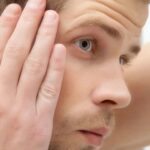 FUE ir DHI Metodo Plaukų Persodinimo Kaina